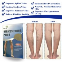 Set 10 Plasturi Hanel pentru varice, ameliorare durere si reducere Inflamatii Set 10 Plasturi Hanel pentru varice, ameliorare durere si reducere Inflamatii